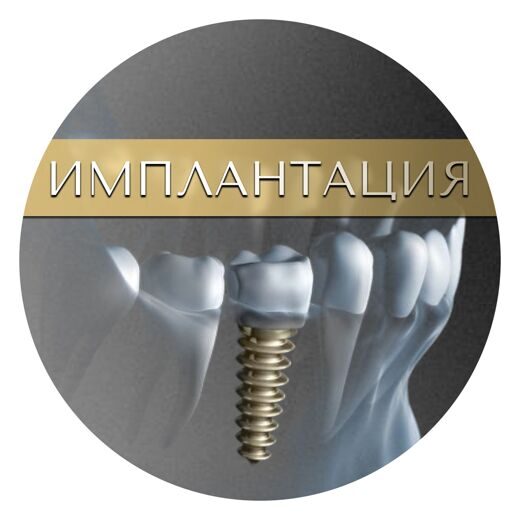 ИМПЛАНТАЦИЯ (1)